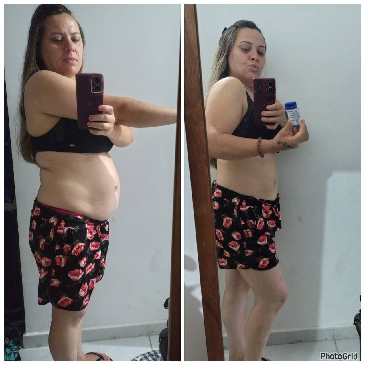 Antes e depois 2 (substitua)